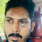 കണ്ണൂർ മയ്യിലിൽ യൂത്ത് കോൺഗ്രസ് നേതാവിന് മർദ്ദനമേറ്റു.
